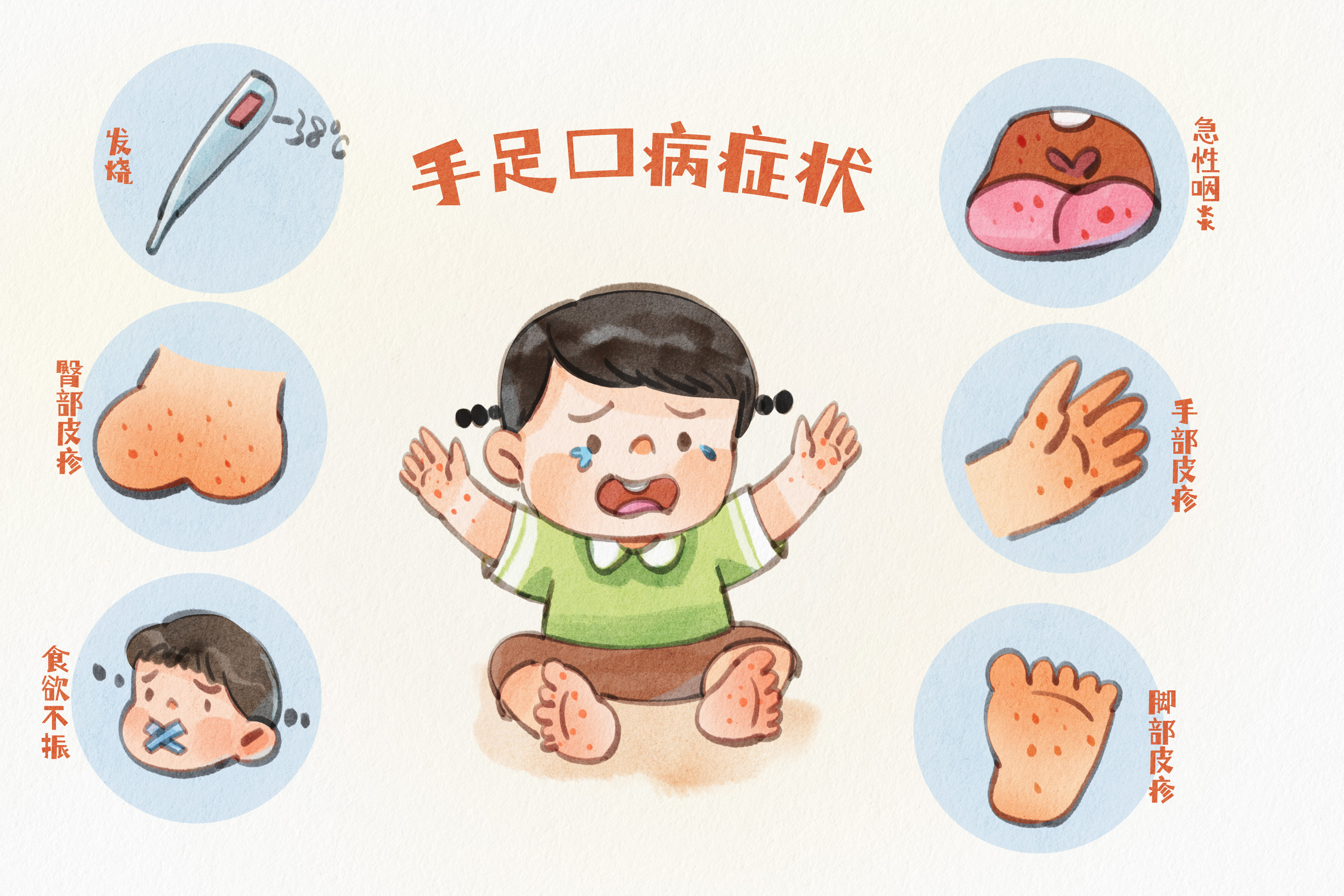 摄图网_403761276_手绘水彩之手足口病症状源插画（企业商用）.jpg